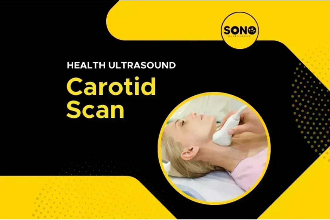 Carotid Scan for Stroke Screening